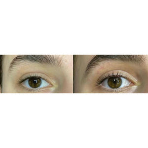 The Power Fol Eye - Multi-Correctional Eyelash & Eyebrow Growth Treatment